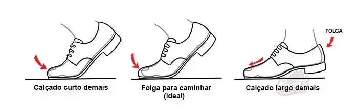 Problemas Comuns Causados por Sapatos com Largura Inadequada Problemas Comuns Causados por Sapatos com Largura Inadequada