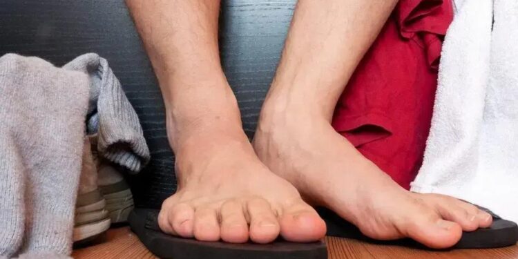 Como se Livrar do Chulé de Vez: Guia Completo