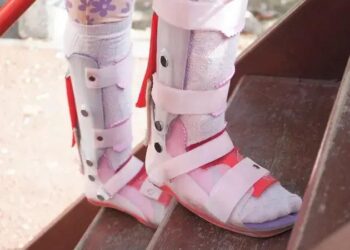 Calçados Ortopédicos Femininos: Conforto e Bem-estar para Seus Pés