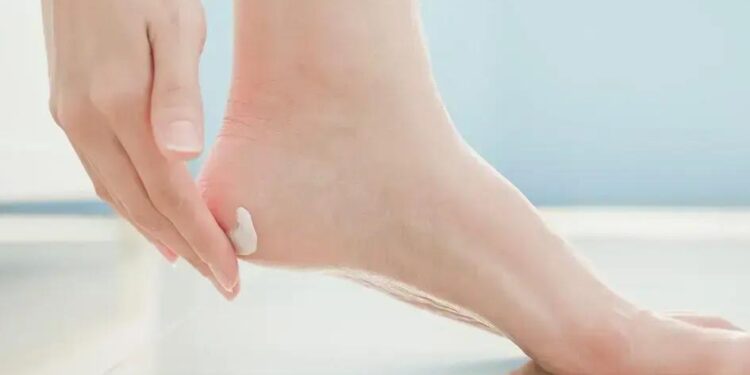 Como Tirar Chulé do Pé Rápido: Guia Infalível Para Eliminar o Odor!